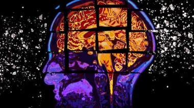 Descubren el mecanismo de avance del Alzheimer en el cerebro