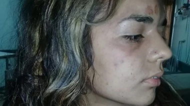 Creyó que había matado a su ex y se entregó, pero la mujer estaba desmayada