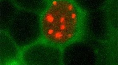 Mientra dormimos, las células nerviosas repararían el daño acumulado en su ADN a lo largo de la vigilia