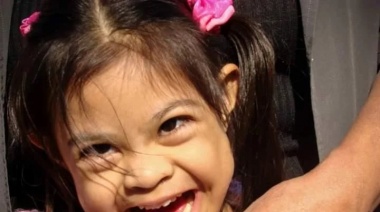 Dos papás adoptaron a una nena con síndrome de down y a fuerza de amor, logró caminar y empezar a hablar