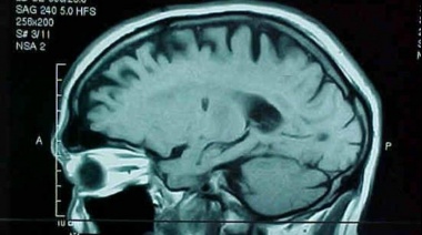 Investigadores crean una nueva terapia CART que logra eliminar el cáncer cerebral
