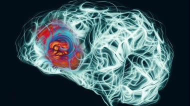 Alzheimer: Cuáles son las tres señales de alerta metabólica a los 35 años