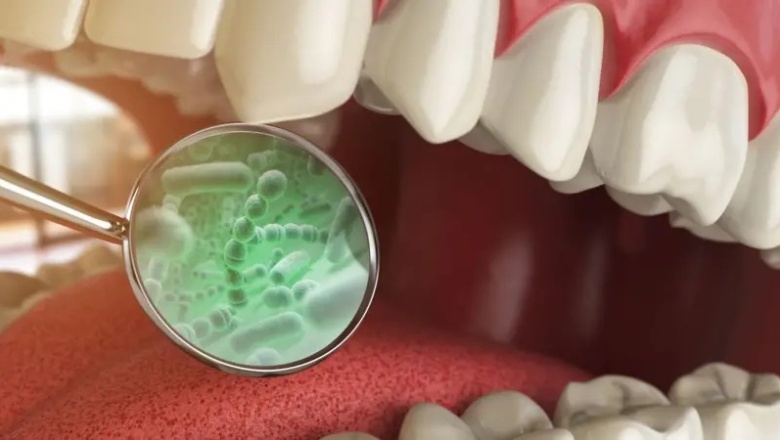 Cáncer de colon y otras 3 enfermedades vinculadas con las bacterias que se encuentran en tu boca