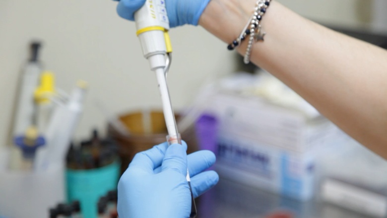 ¿Es realmente necesario ayunar para un análisis de sangre?