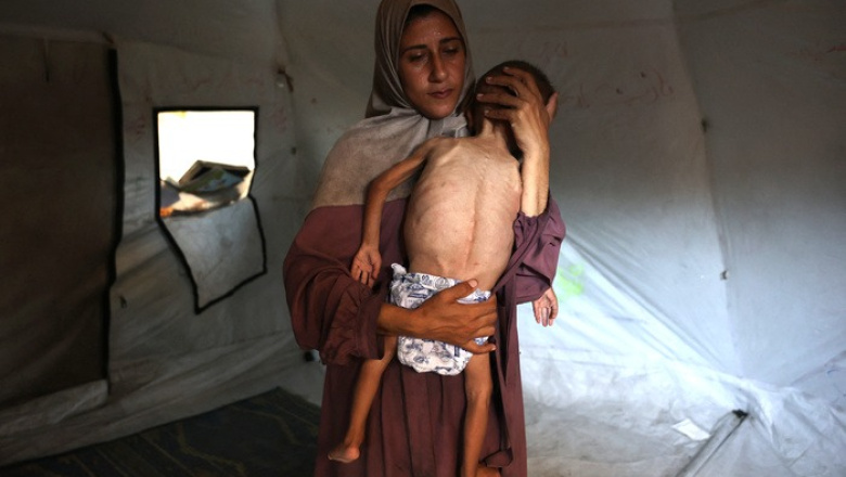 BBC, Associated Press, Reuters y France-Presse advirtieron por la hambruna en Gaza