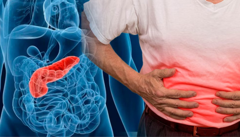 Una terapia experimental logró “interceptar” el cáncer de páncreas al detectar lesiones precursoras del tumor