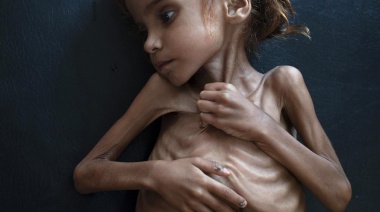 Murió Amal, la chica que se convirtió en un símbolo de la guerra y la hambruna en Yemen