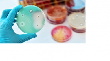 Las infecciones intrahospitalarias ya no son exclusivas de los hospitales