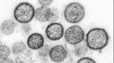 Hantavirus : por qué preocupa el brote que ha causado la muerte de 9 personas