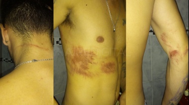 "Mirá cómo lloran los maricones": bestial ataque y violación policial a una pareja gay en Santa Fe