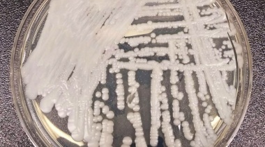 Alertan de que se detectaron en Argentina nuevas superbacterias por el mal uso de antibióticos durante la pandemia