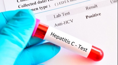 Aprobaron un test rápido para detectar un virus silencioso que afecta a cientos de miles de argentinos