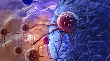 Cáncer de mama: Descubrieron que los tumores se propagan agresivamente mientras los pacientes duermen