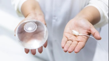 Obesidad: Qué opinan los expertos del nuevo balón gástrico sin cirugía, ni endoscopía