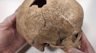 Un estudio del sarro en dientes de miles de años muestra un aspecto desconocido de los humanos del Paleolítico
