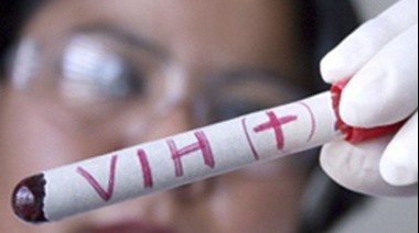 Se registró un nuevo caso de remisión del VIH tras un trasplante de médula ósea
