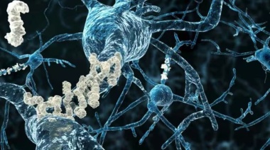 Aprueban una nueva droga para las etapas tempranas del Alzheimer: podría demorar el deterioro cognitivo