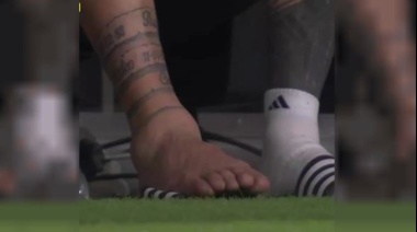 Tremendo: así quedó el tobillo de Messi
