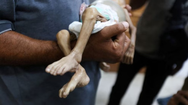 El hambre azota a los hospitales de Gaza: no hay alimentos, las enfermeras se desmayan y escasea la leche para bebés