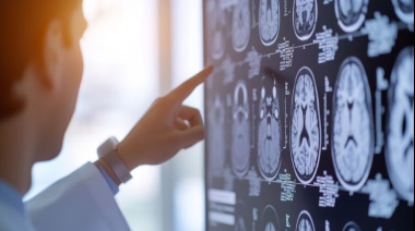 Los cinco síntomas que podrían indicar un ACV y nunca deben subestimarse, según un neurólogo