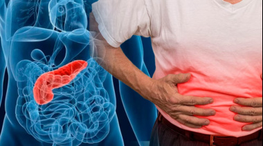 Una terapia experimental logró “interceptar” el cáncer de páncreas al detectar lesiones precursoras del tumor